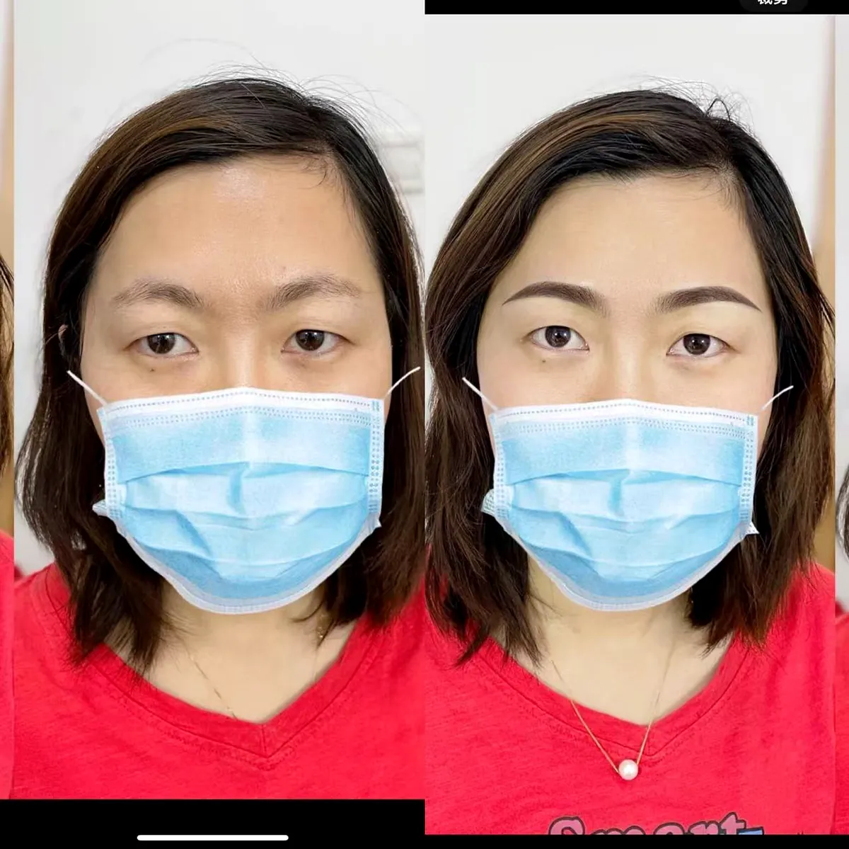 Beauty treatment consultation in Flushing NY